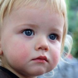 Как кормить ребенка при аллергии?